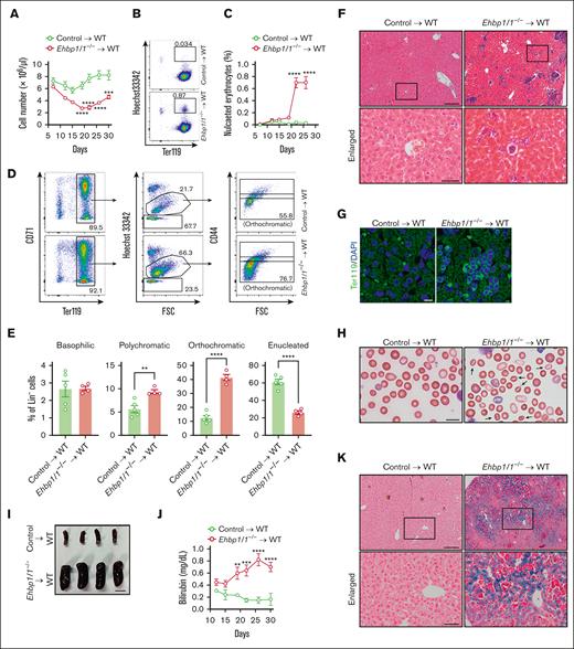 Mice transplanted with Ehbp1l1−/− hematopoietic cells exhibited impaired erythroblast enucleation and hemolytic anemia. FLCs from Ehbp1l1+/+ and Ehbp1l1−/− E14.5 embryos were transplanted into irradiated wild-type mice. (A) Total cell numbers in the peripheral blood at indicated days after transplantation (control: n = 5, Ehbp1l1−/−: n = 4). (B-E) Peripheral blood (B-C) and bone marrow cells (D-E) collected at indicated (B-C) and 35 days (D-E) after transplantation, respectively, were analyzed by flow cytometry (control: n = 5, Ehbp1l1−/−: n = 4). Representative flow cytometry plots are shown (Lin− cells in panel D). (F-H,K) The livers collected 35 days after transplantation were subjected to H&E staining (F), immunohistochemistry for Ter119 (G), and Berlin blue staining (K). The peripheral blood collected 22 days after transplantation was subjected to May-Grunwald-Giemsa staining (H). Representative pictures are shown. The areas enclosed in the black squares were enlarged (F,K). Arrows indicate stomatocytes (H). (I) A representative picture of the spleens collected 35 days after transplantation is shown. (J) The bilirubin concentration in the serum at indicated days after transplantation was determined by using the UnaG protein (control: n = 4 and Ehbp1l1−/−: n = 4). Scale bars: 200 and 50 μm in enlarged pictures for panels F,K, 10 μm for panels G-H, 1 cm for panel I. The data are presented as means ± SEMs for panels A,C,E,J. ∗∗P < .01, ∗∗∗P < .001, ∗∗∗∗P < .0001 (2-way ANOVA in panels A,C,J; unpaired t test with Welch’s correction in panel E).