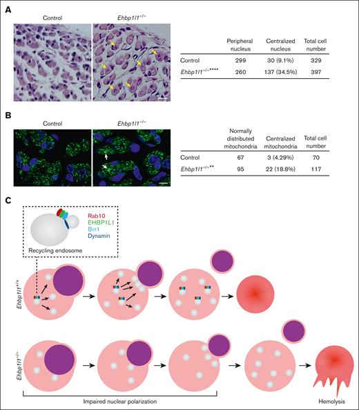 Loss of EHBP1L1 causes abnormal central positioning of nuclei and mitochondria in skeletal muscle cells. (A-B) Representative images of HE staining (A) and immunofluorescence staining for the mitochondrial marker COXIV (B) in hindlimb muscles from E18.5 embryos are shown. The numbers of skeletal muscle cells with centralized nuclei (yellow arrows in panel A) and centrally accumulated mitochondria (white arrows in panel B) were determined (6 visual fields for each genotype in panel A; 4 visual fields for control mice and 5 visual fields for Ehbp1l1−/− mice in panel B). Bars: 20 μm for panel A and 10 μm for panel B. ∗∗P < .01, ∗∗∗∗P < .0001 (Fisher exact test). (C) A schematic diagram illustrating the function of EHBP1L1 in terminal erythropoiesis is shown.