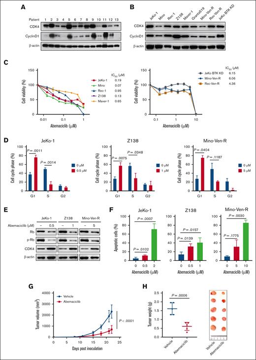 Abemaciclib exerts antiMCL efficacy by inhibiting cell cycle progression and inducing apoptosis, both in vitro and in vivo. (A-B) Expression of cell cycle regulators in primary patient samples with MCL (A) and MCL cell lines (B). (C) Abemaciclib inhibits cell viability after exposure to increasing concentrations of abemaciclib for 72 hours in MCL cell lines. The IC50 values are shown on the right. Data are presented as mean ± SD. The results are representative of 3 biological replicates. (D) Abemaciclib causes cell cycle arrest at G1 phase after exposure to abemaciclib for 24 hours. Data are indicated as mean ± SD. The results are representative of 3 biological replicates. (E) Representative immunoblot shows the downregulation of p-Rb after 12 hours of treatment with the same doses of abemaciclib shown in (D). (F) Abemaciclib induces dose-dependent apoptosis in MCL cell lines after 48 hours of treatment detected by annexin V/Propidium iodide-binding assay. Results are representative of 3 biological replicates. (G-H) Abemaciclib (10 mg/kg, 5 days per week) inhibits the tumor growth in patient-derived xenograft mouse models (derived from a patient resistant to CD19 CAR T-cell therapy). Tumor volume was monitored and plotted (G). Tumor weights and images at the end of the experiment are presented (H). SD, standard deviation.