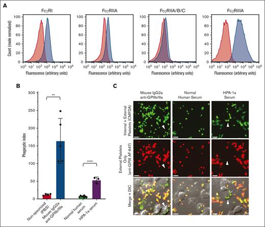 THP-1-CD16A macrophages phagocytosed human platelets opsonized with IgG anti-GPIIb/IIIa antibodies. (A) THP-1-CD16A surface expression of FcγRs was evaluated by flow cytometry using fluorescent antibodies to FcγRI (clone 10.1), FcγRIIA (IV.3), all FcγRII isoforms (FcγRIIA/B/C) (AT10), and FcγRIII (3G8). Histograms from a representative experiment are presented. Red shade histogram = unstained control; blue shade histogram = macrophages stained with fluorescent antibody. y-axis, counts (normalized to mode); x-axis, log10 fluorescence intensity. (B) THP-1-CD16A macrophage phagocytosis of platelets opsonized with anti-GPIIb/IIIa mouse IgG2a antibody clone A2A9/6 or human serum positive for HPA-1a alloantibodies (HPA-1a serum). Phagocytosis was quantified from fluorescent photomicrographs as described in the “Methods.” Phagocytic index: number of phagocytosed platelets per 100 counted macrophages. Statistical significance was calculated by performing unpaired, parametric t tests; ∗∗P < .01; ∗∗∗∗P < .001. Data error: mean ± 1 standard deviation (SD). (C) Example of confocal photomicrographs of THP-1-CD16A macrophages after incubation with human platelets opsonized anti-GPIIb/IIIa antibodies (clone A2A9/6, HPA-1a serum) or NHS. White arrows point toward example macrophages with phagocytosed platelets. Platelets were labeled with the cytoplasmic dye 5-chloromethylfluorescein diacetate (CMFDA) (green, top row). External (nonphagocytosed) platelets were identified after phagocytosis using an AlexaFluor 647 (AF647)-conjugated anti-GPIX antibody (red, middle row). Merged fluorescence and differential interference contrast (DIC) images are shown in the bottom row. Areas of red and green colocalization in the merge appear as yellow-orange (nonphagocytosed) vs green (phagocytosed) platelets. Scale bar, 10 μM. Photomicrographs were taken by spinning-disk confocal microscopy under 63× objective oil immersion (numerical aperture 1.47) with DIC and laser fluorescence (488, 647) channels on a Quorum multimodal imaging system equipped with 50 μm pinhole spinning disk and ORCA-Flash 4.0 V2 PLUS sCMOS camera. At least 4 images at distinct locations were taken near the center of each coverslip with Z-stacking every 0.33 μm. Z-stacked images were 3D reconstructed for analysis using Imaris v8.0.2.