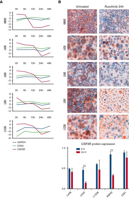Downregulation of CSF3R expression. (A) CSF3R GE changes over time (log2-fold change) in cHL-derived cell lines compared with 2 different controls: GAPDH and CD30 (TNFRSF8). (B) CSF3R protein expression measured by IHC (cytospin preparations) to compare untreated (left) with ruxolitinib-treated (right) cell lines. The histogram illustrates the pattern of IHC quantification (two-way ANOVA: ∗∗∗P < .001). ANOVA, analysis of variance.