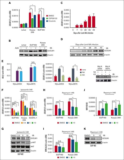 GOLM1 is upregulated by NA. (A) The ALK inhibitor reduces the transcription level of GOLM1 in ALK+ ALCL cells. The total RNA from ALK+ ALCL (SUP-M2 and Karpas 299) and Jurkat T-cell lines with or without treatment of the ALK inhibitors CEP28122 (100 nM)41 or crizotinib (2 μM)42 for 24 hours were subjected RT-qPCR analysis. (B) The ALK inhibitor reduces the protein level of GOLM1 in ALK+ ALCL cells. The whole cell lysate from ALK+ ALCL (SUP-M2 and Karpas 299) and Jurkat cell lines with or without treatment of ALK inhibitor CEP28122 (100 nM) for 24 hours were subjected to western blotting. (C-D) Purified CD4+ T cells were stimulated with anti-CD3/CD28 beads and either transduced with wild-type NA or KD or left uninfected, then cultured in CO2 incubator. Cells were count and expanded according to previous description.12 GOLM1 mRNA and protein were gradually increased during human T-cell transformation process upon lentivirus-encoded NA (Lenti-NA) infection. Samples were collected at 0, 7, 14, 28, 35, and 49 days after infection. (E) The mRNA and protein levels of GOLM1 in MyLa2059 and MyLa3675 cells transduced with NA or its KD mutant were individually detected by qPCR and western blot. (F-K) The pan-AKT inhibitor Ipatasertib and mTOR inhibitor rapamycin reduced the transcription and protein levels of GOLM1 in ALK+ ALCL cells. The total RNA and cell lysate from ALK+ ALCL cell lines with or without treatment of Ipatasertib or rapamycin at indicated concentration for 24 hours were subjected qPCR and western blot analysis. (∗P < .05, ∗∗∗P < .001, 2-tailed Student t test).