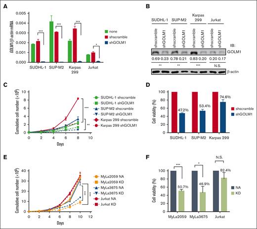 Inhibition of GOLM1 expression in ALK+ ALCL cells reduces cell viability. (A) Establishment of GOLM1 stable knockdown in ALK+ALCL (SUDHL-1, SUP-M2, and Karpas 299) and Jurkat cells. Cells were infected by lentivirus-encoded GOLM1 or scramble shRNA, and stable clones were selected. The GOLM1 mRNA and (B) protein were detected by qPCR or western blotting (∗P < .05, ∗∗∗P < .001, 2-tailed Student t test). (C) The growth curves of GOLM1 knockdown ALK+ ALCL cells and (D) NA or KD expressing ALK- cells. The shGOLM1 or shscramble ALK+ ALCL cells were seeded as 1 × 105 per well (200 μL) for expansion. The cells were counted and seeded as 1 × 105 per well (200 μL) every other day during 8 or 10 days period. (E) The viability of GOLM1 knockdown ALK+ ALCL cells and (F) NA or KD expressing ALK- ALCL cells. The cells were seeded as 1 × 105 per well (200 μL). Cell viability was determined by trypan blue staining.