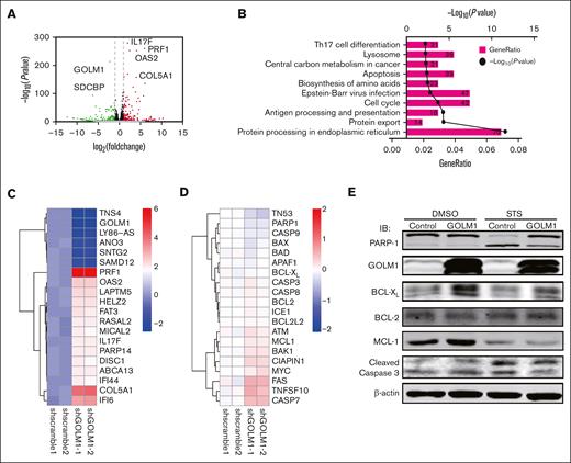 GOLM1 expression increase the expression of BCL-XL. (A) RNA-seq was performed for shGOLM1 or shscramble SUP-M2 cells and the differentially expressed genes were analyzed and presented as a volcano plot. (B) Functional pathway analysis performed by Database for Annotation, Visualization, and Integrated Discovery and KEGG database, and the top 10 most significant pathway are presented as GO terms. (C) The heat map depicts most changed genes in shGOLM1 RNA-seq data compared with scramble samples. (D) The heat map shows no genes significantly change in apoptosis pathway in in shGOLM1 RNA-seq data compared with scramble samples, which was analyzed and plotted by R project software. (E) SUP-M2 cells with GOLM1 overexpression or control were treated with DMSO or STS, and then the protein levels of PARP-1, BCL-XL, BCL-2, MCL-1, GOLM1, and cleaved caspase 3 were detected by western blotting. GO, Gene Ontology; MCL, myeloid cell leukemia.