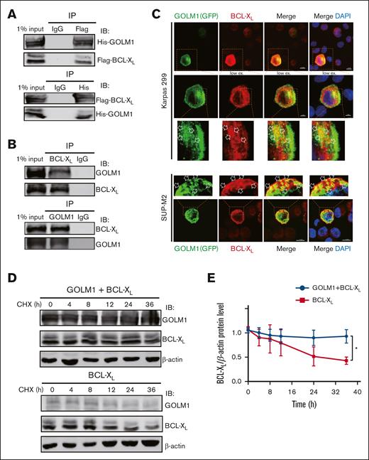 GOLM1 blocks cell apoptosis through stabilizing BCL-XL. (A) Exogenous GOLM1 associates with BCL-XL. 293T cells cotransfected with His-GOLM1 and Flag-BCL-XL, were subjected co-immunoprecipitation (IP) followed by immunoblotting (IB) as indicated antibodies. (B) Endogenous GOLM1 interacts with BCL-XL. SUP-M2 cells were subjected co-IP followed by immunoblotting (IB) as indicated antibodies. Normal immunoglobulin G (IgG) is used as control. (C) Representative images with GOLM1-GFP and BCL-XL coexpression (scale bar, 5 μm) in SUP-M2 and Karpas 299 cells. Cells were transfected with plasmid encoded GOLM1-GFP and performed immunofluerescent staining with anti- BCL-XL antibody. The colocalization of GOLM1-GFP and BCL-XL is indicated by an arrow. (D) 293T cells transfected by BCL-XL alone or with GOLM1 were treated with CHX and harvested at indicated time points. (E) The relative intensity of each band in panel D were quantitated by Image J software. (∗P < .05, ∗∗∗P < .001, 2-tailed Student t test).