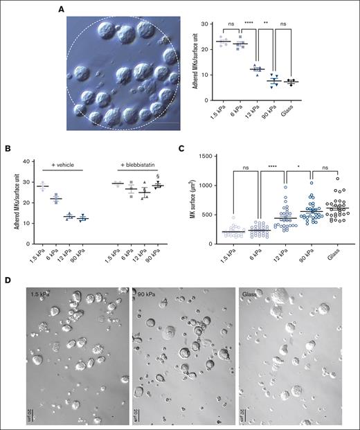 MKs sense FN-coated substrate stiffness. (A) MK adhesion for 2 hours onto PDMS substrate of various stiffness coated with FN 50 μg/mL using microcontact printing (circular patterns of 200 μm diameter). (Left) bright field image illustrating MK adhesion, bar is 50 μm; (right) quantification of the number of MK adhered per unit surface. (B) Effect of blebbistatin (100 μM) on MK adhesion. (A-B) Mean ± standard error of mean (SEM). Dots represent independent experiments (mean of 6-9 replicates); 2-way ANOVA analysis and Šidák multiple comparisons test, § indicates P < .0001, comparing the control condition with same substrate stiffness. (C-D) MK adhered for 5 hours and observed by bright field microscopy; (C) measurement of the visible surface of each MK measured; mean ± SEM, n = 3 independent experiments; statistics, ordinary 1-way ANOVA with Tukey multiple comparisons test. (D) Photomicrographs illustrating bright field microscopy observations; representative of at least 8 independent experiments; scale bar, 20 μm.