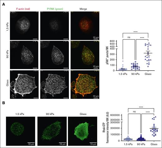 Stiff matrix promotes higher intracellular signaling. (A) (Left) Higher FAK phosphorylation upon MK adhesion on stiff substrates. Red, F-actin; green, P-FAK. Scale bars, 10 μm. (Right) Quantification of P-FAK positive puncta per MK; mean ± SEM (20-25 MKs, 2 independent experiments). (B) (Left), RhoA–guanosine triphosphate immunolabeling. Scale bars, 15 μm. (Right) Higher RhoA activity upon MK adhesion on stiff substrate; mean ± SEM (53 MKs for 1.5 kPa, 69 MKs for 90 kPa, and 27 MKs for glass surface; 3 independent experiments). Ordinary 1-way ANOVA with Tukey multiple comparisons test.