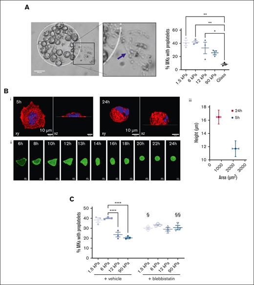 Soft matrix is preferred for proplatelet formation. (A) (Left) Bright field image of MK forming proplatelets after 24 hours adhesion on the 1.5 kPa FN micropattern. Scale bar, 50 μm. (Right) Quantification of MK forming proplatelets depending on the matrix stiffness. Ordinary 1-way ANOVA with Tukey multiple comparisons test, mean ± SEM, n = 3 independent experiments, each dot is the mean of 9 replicates. (B) Decreased spreading after 24 hours adhesion. (i) xy and xz view of a MKs adhered for 5 or 24 hours; red, F-actin, blue, nucleus. Scale bar, 10 μm; (ii) time-lapse of a MK expressing Lifeact-GFP (green); acquisition was one every hour and started 6 hours after seeding; bar is 10 μm. (iii) Co-relation between spreading area and height of MKs adhered for 5 hours or 24 hours on FN-coated glass surface. Mean ± SEM from 25 MKs in 2 independent experiments. (C) Impact of blebbistatin on proplatelet formation on the different substrate stiffness after 24 hours adhesion; n = 3 independent experiments; each dot is the mean of 9 replicates ± SEM. For the vehicle group, statistical analysis was performed with ordinary 1-way ANOVA and Tukey multiple comparisons; ∗∗∗∗P < .0001. Comparison between vehicle and blebistatin was with 2-way ANOVA and Šidák multiple comparisons; §P < .05, §§P < .01, comparison between vehicle and blebbistatin treatment for a same stiffness.