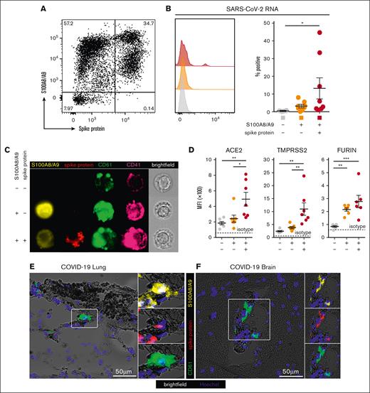 A subpopulation of S100A8/A9+ MKs contain SARS-CoV-2. (A) Representative flow cytometry plot of circulating MKs showing 3 distinct subpopulations: S100A8/A9− spike protein–negative, S100A8/A9+ spike protein–negative, and S100A8/A9+ spike protein–positive. (B) Histogram showing PrimeFlow flow cytometry for SARS-CoV-2 RNA in circulating MKs. Quantification of SARS-CoV-2 RNA in the 3 MK subpopulations (n = 8 donors). One-way ANOVA with Tukey post hoc multiple comparisons test; adjusted P value is ∗P = .05 to .01 (C) Representative imaging flow cytometry from FACS-sorted MKs: S100A8/A9− spike protein–negative, S100A8/A9+ spike protein–negative, and S100A8/A9+ spike protein–positive. (D) Expression of proteins involved in SARS-CoV-2 viral infection in the 3 MK subpopulations (n = 7 donors). Mean fluorescent intensity of ACE2, TMPRSS2, and FURIN. Dashed lines represent the geometric mean for isotype controls. One-way ANOVA with Tukey post hoc multiple comparisons test; ∗P = .05 to .01; ∗∗P = .01 to .001; ∗∗∗P = .001 to .0001. (E) Immunofluorescence staining of lung tissue from a deceased patient who had COVID-19 with ARDS. (F) Immunofluorescence staining of brain tissue (cortex) from a deceased patient who had COVID-19. Five channels are shown in panels E-F: brightfield (black pigment from TrueView autofluorescence quencher), green (CD61), yellow (S100A8/A9), red (spike protein), and blue (Hoechst). All graphs are mean ± SEM. TMPRSS2, transmembrane protease serine 2.