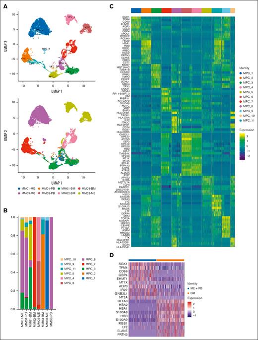Single-cell atlas of malignant plasma cells (MPCs) from patients with MM. (A) Analysis of 17 599 MPCs color-coded using UMAP based on the cluster. (B) Proportion of MPCs in the BM and PB of 3 patients with MM. (C) Heatmaps of DEGs for each cluster in MPCs. (D) DEGs in MPCs from BM and extramedullary sites (ME + PB).