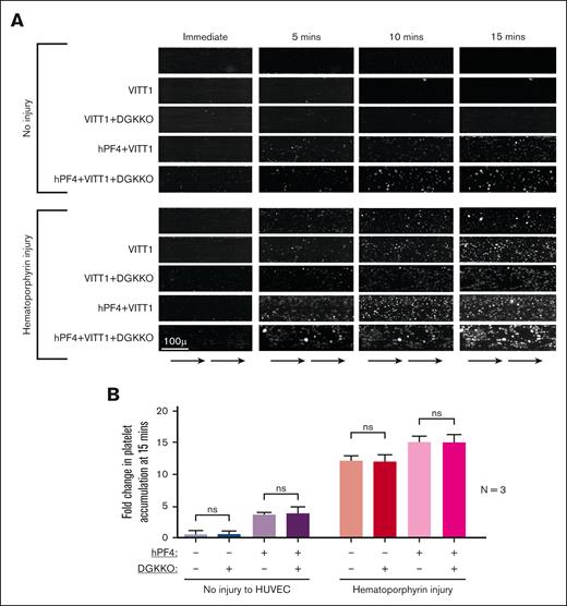 Effect of DGKKO on VITT thrombosis in a microfluidic system. Studies were performed as described in Figure 2 but in the presence of IgG isolated from 3 patients with VITT, in duplicates. (A) Representative studies from 1 patient with VITT (patient VITT1). (B) Cumulative data of studies with IgGs isolated from patients with VITT (VITT1-VITT3).
