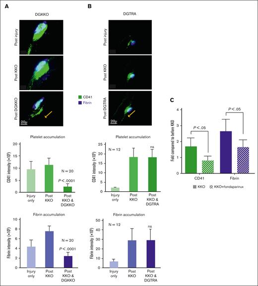 Effect of DGKKO and fondaparinux on thrombosis induced by KKO in a murine model of HIT. Cremaster arteriole injury followed by infused KKO. HIT prothrombotic studies done as outlined in supplemental Figure 2C. (A) (Top) Representative image of 5 minutes after injury vs 15 minutes after KKO infusion vs 30 minutes after DGKKO infusion on platelet and fibrin accumulation. Scale bar is included, as is the arrow indicating the direction of flow. (Middle) Quantitative analysis of platelet accumulation at the site of injury before and after KKO and then after DGKKO. Mean ± 1 SEM are shown. P values were determined using 2-way Student t test, comparing platelet accumulation after KKO vs after DGKKO. (Bottom) Same as the middle graph but for fibrin accumulation. (B) Same as panel A but DGTRA-infused after KKO rather than after DGKKO. (C) Cremaster arteriole injury followed by KKO or KKO + fondaparinux. Data are expressed as the fold change of platelet accumulation and fibrin deposition after KKO (1 mg/kg) or KKO + fondaparinux injection (1 μg/kg) compared with that from before the therapy. Values greater than 1 are consistent with a prothrombotic effect. n = 3 studies per arm; P values were determined using Student t test.