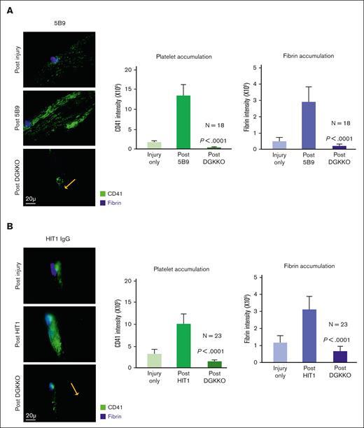 Effect of DGKKO on thrombosis, as induced by 5B9 and HIT IgG in a murine model of HIT. Thrombus formation in HIT mice was examined as described in Figure 5 but substituting 5B9 (A) and HIT1 IgG (B).