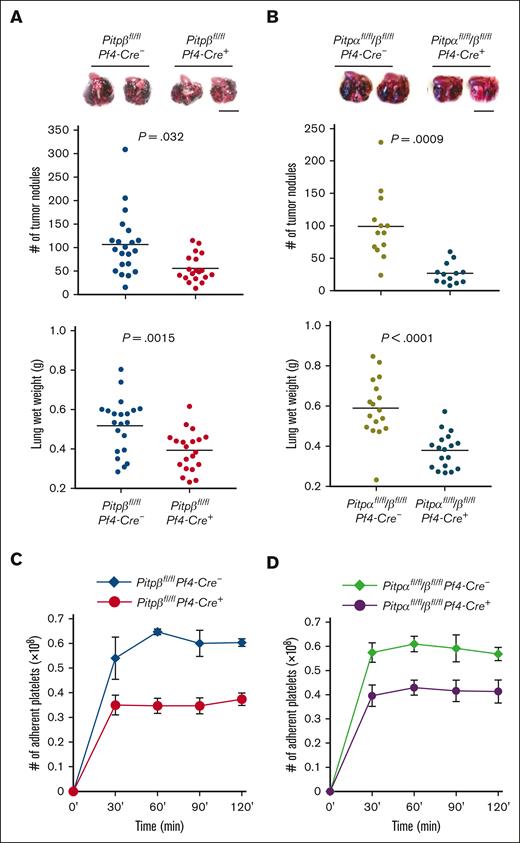 Platelets lacking PITPβ or both PITP isoforms are less susceptible to tumor metastasis. (A,B) Lungs harvested from Pitpβfl/flPf4-Cre- and Pitpβfl/flPf4-Cre+ mice (A) or Pitpαfl/fl/βfl/flPf4-Cre- and Pitpαfl/fl/βfl/flPf4-Cre+ mice (B) 2 weeks after tail vein injection with B16F10 melanoma cells demonstrated that loss of PITP impairs metastasis. Representative lungs are shown at 2 weeks after tumor cell injection (top); the number of tumor nodules on the lung surface 2 weeks after tumor cell injection (middle); and wet lung weights 3 weeks after tumor injection (bottom). For tumor nodule counting, n = 21 lungs for Pitpβfl/flPf4-Cre- mice, n = 19 for Pitpβfl/flPf4-Cre+ mice, and n = 13 for both Pitpαfl/fl/βfl/flPf4-Cre- mice and Pitpαfl/fl/βfl/flPf4-Cre+ mice. For lung weight, n = 21 lungs for Pitpβfl/flPf4-Cre- mice, n = 20 for Pitpβfl/flPf4-Cre+ mice, n = 17 for Pitpαfl/fl/βfl/flPf4-Cre- mice, and n = 18 for Pitpαfl/fl/βfl/flPf4-Cre+ mice. Statistical analysis was performed using an unpaired t test. Black scale bars represent 10 mm. (C,D) Ex vivo adhesion of PITPβ-null (C) or PITPα/β-null (D) platelets to a tissue-cultured tumor cell monolayer was impaired compared with wild-type controls. Error bars represent s.d.; n = 3 for each genotype.