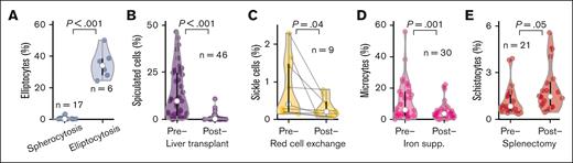 The RBC-diff accurately detects physiologic and clinical signals. Comparison of RBC-diff counts across 5 cohorts with expected morphologic differences driven by physiologic shifts or clinical interventions: (A) hereditary spherocytosis and elliptocytosis, (B) before and after liver transplantation, (C), before and after RBC exchange in patients with sickle cell disease, (D) before and after intravenous iron supplementation in patients with iron-deficiency anemia, and (E) before and after splenectomy. RBC-diff counts for all morphologies of the patients in panels A-E are shown in supplemental Figure 4. The test statistics for panels A-E are 16.0, 6.16, 2.39, 3.90, and 2.09, respectively. Black lines reflect interquartile range, white circles represent median, and violin shapes the data distribution.