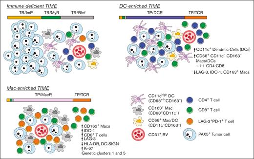 Model showing the topographical organization of tumor and immune cells in DLBCLs with immune-deficient, DC-enriched, and Mac-enriched TIMEs. (Top left) DLBCLs with immune-deficient TIMEs are characterized by cells in tumor-rich (TR) CNTs. Individual cell neighborhoods furthest from blood vessels have very few immune cells compared with tumor cells and are organized as TR/ImP neighborhoods, consistent with immune exclusion. Individual cell neighborhoods closer to blood vessels are characterized by greater, but still a minor, number of immune cells compared to tumor cells and include greater numbers of myeloid and DCs than T cells organized as TR/MyR neighborhoods, suggestive of ongoing antigen sampling and limited T-cell stimulation. Regions nearest blood vessels show the highest numbers of immune cells relative to tumor cells. They include a variety of cell lineages organized as TR/BInf neighborhoods, consistent with extravasation of multiple immune cell types into the local microenvironment. (Top right) DLBCLs with DC-enriched TIMEs are characterized by cells organized as tumor-poor (TP) and TR CNTs. Uniquely to DLBCLs with DC-enriched TIMEs, regions nearest blood vessels show expanded numbers of T cells in TP/TCR neighborhoods and expanded numbers of DCs, CD4+ and CD8+ T cells in TP/DCR neighborhoods. Cells in TP/TCR and TP/DCR neighborhoods are enriched near blood vessels but also extend into the tumor parenchyma, suggestive of an active immune response. (Bottom left) DLBCLs with Mac-enriched TIMEs are characterized by cells organized as TP CNTs in addition to TR CNTs. Uniquely to DLBCLs with Mac-enriched TIMEs, regions close to and far from blood vessels show expanded numbers of T cells in TP/TCR neighborhoods and expanded numbers of CD163+ M2-like macrophages, IDO-1+ myeloid cells, CD8+ T cells, and PD-1+LAG-3+ exhausted T cells in the TP/MacR neighborhoods. In addition, there is lower HLA-DR expression in TP/ImP neighborhoods, suggestive of reduced immune stimulation. BV, blood vessel.