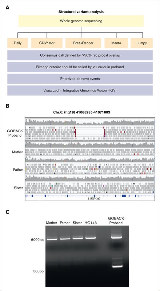Identification of a novel de novo germline deletion in USP9X in a child with congenital anomalies and B-ALL. (A) Schematic of the SV analysis pipeline used to analyze WGS of 78 DNA samples. Five SV callers (orange boxes) were used based on their ability to detect distinct patterns in aligned reads. SV calls were merged, filtered, prioritized, and visualized as described (blue boxes). (B) IGV image showing break points of the de novo heterozygous deletion in USP9X in the GOBACK proband. (C) PCR validation of the deletion in DNA from the GOBACK proband, family members, and lymphoblastoid cell line (HG148) control.