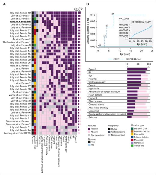 Germline variants in USP9X are associated with multiple congenital anomalies, intellectual disability, and an increased risk of B-ALL. (A) Oncoprint analysis showing major categories of phenotypes (columns) found in individual probands (rows) in decreasing order of frequency (right to left and top to bottom, respectively) and also summarized with the percentages in the bottom right of the figure. The left 3 columns depict malignancy (presence of B-ALL is shown in black and osteosarcoma in dark grey), mutation types (deletion of 5' UTR shown in dark green, deletion >5kb in brown, frameshift in yellow, inframe in blue, missense in red, nonsense in purple and splice site in green), and whether the variant was de novo or not (shown in black vs blue, respectively). (B) Cumulative incidence plot of female patients with germline LoF variants in USP9X diagnosed with B-ALL compared with age- and sex-adjusted patients with B-ALL in the SEER database.