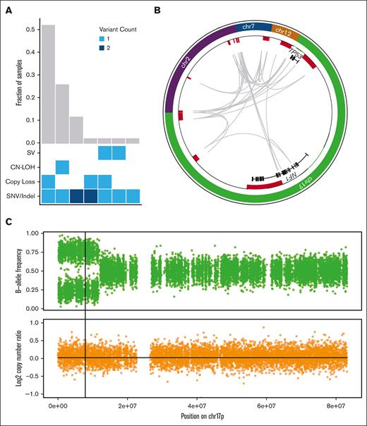 WGS results in the reclassification of some cases of TP53-mutated MDS/AML. (A) Combinations of mutation types affecting TP53 in AML/MDS cases, and corresponding proportion in cohort. (B) Complex SV affecting the TP53 genetic locus is detected using WGS based on resolution of rearrangements involving ch7, chr12, chr2, and NF1 on chr17p. Copy-number losses are shown in red. Gray arcs indicate regions linked by SV. (C) CN-LOH affecting chr17p is detected using WGS based on shifts in B-allele frequency (top) whereas log2 copy-number ratio remains 0 (bottom). Vertical line indicates the position of the TP53 locus.