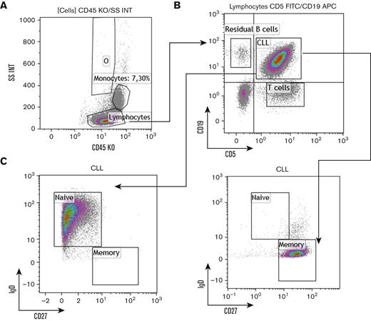 Gating strategy and naive/memory B-cell profile in MFC. (A) Lymphocytes were gated as CD45+/SS low cells. (B) Then, CLL cells were gated as CD19+/CD5+ lymphocytes. Normal residual B cells are CD19+/CD5− lymphocytes. (C) Naive (IgD+/CD27−) and memory (IgD−/CD27+) status of B-cell lymphocytes was finally determined.