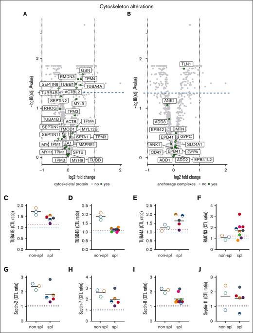 Among cytoskeletal and anchorage proteins, tubulins and septins are modified in content upon splenectomy. RBCs from patients, either spl (filled circles or semifilled circles for intrafamily comparison) or nonspl (open circles), and RBCs from CTLs (dark blue dotted line, CTL ratio) or a healthy splenectomized adult donor (red dotted line) were assessed by differential quantitative mass spectrometry for cytoskeleton and anchorage complex protein membrane association. (A,B) Volcano plots of ghost membranes for cytoskeletal and anchorage complex proteins (extension of Figure 2A-B). Volcano plots show the log2 of the fold changes (logFC) and the adjusted P values associated with the splenectomy effect. Proteins showing a negative or a positive logFC have a lower or higher expression level in splenectomized patients, respectively. Proteins above the dotted line show a significant difference (P < .05) in the splenectomized patient cohort as compared with the nonsplenectomized one. (C-F) Tubulin α 1b (TUBA1B), TUBB4B, TUBA4A, and regulator of microtubule dynamics protein 3 (RMDN3) membrane association. (G-J) Septins-2, -7, -8, -11 ghost membrane association.