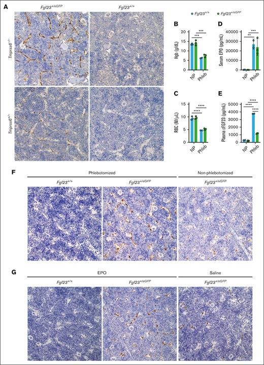 BM-SECs are a site of Fgf23 upregulation in genetically induced IDA, in phlebotomy-induced anemia, and after the direct administration of EPO. (A) Immunohistochemical staining with an anti-GFP antibody in the BM of formalin-fixed, decalcified femur sections of selected Tmprss6-Fgf23 genotype combinations (6-month-old male mice). Original magnification ×40. Brown staining highlights anti-GFP immunoreactivity; blue staining reflects hematoxylin counterstain. (B-E) Circulating parameters in Fgf23+/eGFP and Fgf23+/+ mice evaluated at the 18-hour time point after a large-volume phlebotomy, compared with nonphlebotomized, genotype-matched controls, validating the expected effects of phlebotomy on (B) Hgb, (C) red blood cell (RBC) count, (D) serum EPO, and (E) plasma cFGF23. Fgf23+/eGFP and Fgf23+/+ female mice (8-weeks-old; 2-4 per group) were either not previously phlebotomized (NP) or underwent a single 500 μL phlebotomy with saline volume replacement 18 hours earlier ("Phleb"). For all graphs, data represent mean ± standard deviation. ∗∗P < .01; ∗∗∗P < .001; and ∗∗∗∗P < .0001 using a two-way ANOVA with Tukey post hoc test. (F) Immunohistochemical staining with anti-GFP antibody in the BM of formalin-fixed, decalcified femur sections harvested 18 hours after a 500 μL phlebotomy (Fgf23+/+ or Fgf23+/eGFP mice) or harvested from nonphlebotomized Fgf23+/eGFP control mice. Original magnification ×40. (G) Immunohistochemical staining with anti-GFP antibody in the BM of formalin-fixed decalcified femur sections harvested 6 hours after injection of EPO (Fgf23+/+ or Fgf23+/eGFP mice) or saline vehicle (Fgf23+/eGFP control mice). Original magnification ×40.
