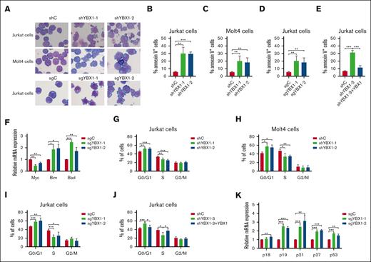 YBX1 depletion induces apoptosis and cell cycle arrest at the G0/G1 phase in Molt4 and Jurkat cells. (A) Representative images of Wright–Giemsa staining for the morphological analysis of Jurkat and Molt4 cells. (B-C) Cell apoptosis was examined in Jurkat (B) and Molt4 cells (C) with YBX1 knockdown by flow cytometry using annexin V/PI staining. Quantification of cell apoptosis in Jurkat (B) and Molt4 cells (C). (D) Jurkat cells were infected via lentiviruses expressing YBX1 sgRNA (sgYBX1-1 or sgYBX1-2). Quantification of apoptosis in Jurkat cells with YBX1 knockout. (E) Percentages of apoptotic leukemia cells after transduction on day 3. (F) qRT-PCR analysis of mRNA expression of cell apoptosis-related genes. (G-J) Cell cycle was analyzed using flow cytometry with PI staining. (K) Relative mRNA expression of cell cycle-related genes. ∗P < .05; ∗∗P < .01; ∗∗∗P < .001.