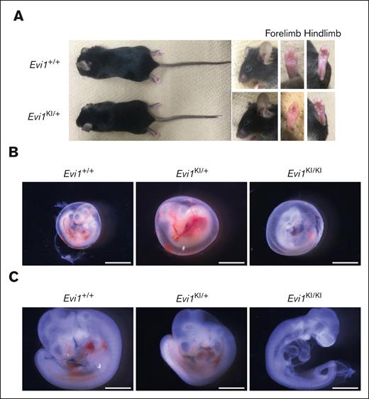 Comparison between Evi1KI/+ and Evi1+/+ mice. (A) External morphology of Evi1+/+ and Evi1KI/+ mice. Images of 10-week-old male littermates. Gross appearance, face, left forelimb, and left hindlimb of Evi1KI/+ mice compared with those of Evi1+/+ mice. There are no external morphological abnormalities. (B) Representative embryos in their yolk sacs at E10.5. The Evi1KI/KI embryo has an avascular yolk sac. Bars represent 2.4 mm. (C) Representative Evi1+/+, Evi1KI/+, and Evi1KI/KI littermates at E10.5. The Evi1KI/KI embryo has a flattened head and poor vascularization. Its size is almost the same as the size of Evi1+/+ and Evi1KI/+ mice. Bars represent 1.2 mm.