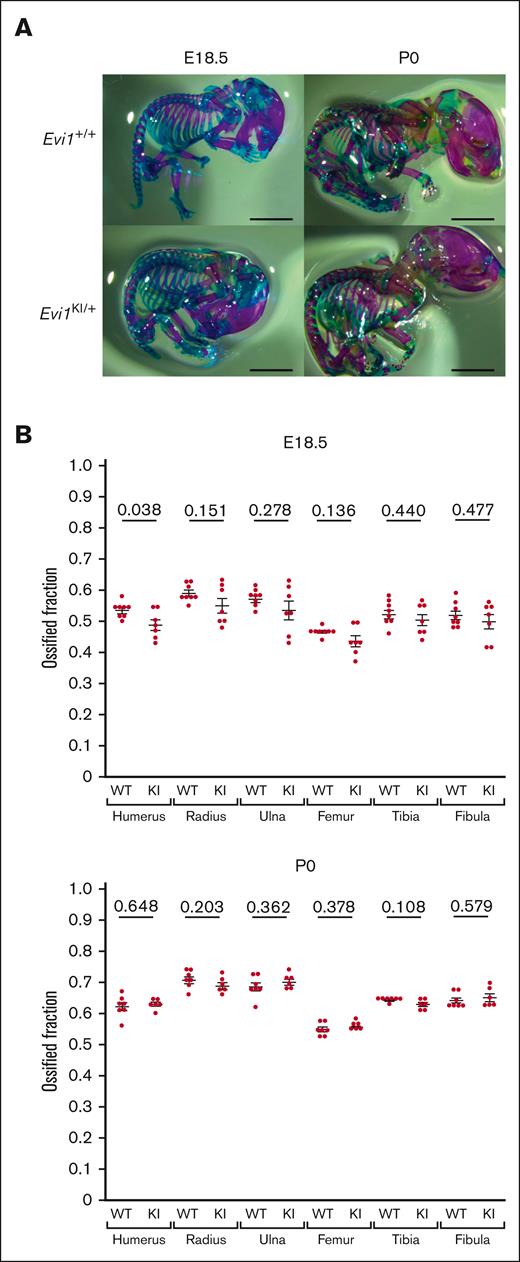 Evi1KI/+ mice show mild ossification delay. (A) Alcian blue and Alizarin red staining of Evi1+/+ mice and Evi1KI/+ mice at E18.5 and P0. Bars represent 5 mm. The ossified fraction was used to evaluate ossification, based on the study by Chang et al.24 (B) Ossification of Evi1+/+ and Evi1KI/+ mice. At E18.5, although only the comparison of the humeral ossification was statistically significant, Evi1KI/+ mice (n = 7) exhibited delayed ossification compared with Evi1+/+ mice (n = 8). At P0, there was no significant difference between the ossification of Evi1+/+ mice (n = 7) and Evi1KI/+ mice (n = 6). Threshold significance level, P = .05 (2-tailed Welch t test). Underlined numbers denote the P value. Values are the mean ± SEM of each group. WT, Evi1+/+ mice; KI, Evi1KI/+ mice.