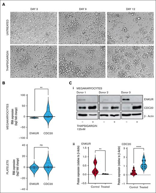 Effect of ER stress on MKS derived from CD34+ cells from healthy donors. (A) Representative microscopic images of the CD34+ cells isolated from the peripheral blood of healthy donors over the 15-day culture period at original magnification ×20. The ER stressor, thapsigargin (125 nM), was added to the culture at day 7 and cultured for another 7 days. (B) RNA expression: cell culture from thapsigargin-treated CD34+-derived MKs (n = 7). (C) (1) Western blot of the thapsigargin-treated CD34+ cells–derived megakaryocytes (n = 3 in triplicate) and (2) densitometry for the blots. Densitometry was performed using the ImageJ software (∗∗∗∗P < .0001; ∗∗P < .01, when compared with untreated controls).