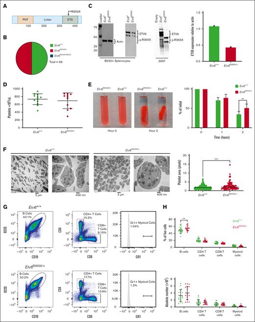 Etv6R355X is homozygous lethal and heterozygotes display abnormal platelets and increased B cells. (A) Schematic diagram depicting the functional domains of ETV6 and location of the ETV6:p.R359X variant. (B) Genotypes generated by Etv6R355X/+ × Etv6R355X/+ mating, showing no Etv6R355X/R355X pups. (C) Western blot and quantification of ETV6 protein levels in B220-enriched splenocytes from Etv6+/+ and Etv6R355X/+ mice as well as 293 T cells transfected with empty vector, wild-type Etv6, or Etv6R355X. Etv6 contains an alternative initiation site at M43 resulting in 2 bands visible by western blot. (D) Peripheral blood platelet count in Etv6+/+ (n = 12) and Etv6R355X/+ (n = 11) mice. Data are from 2 combined experiments and show mean ± standard deviation (SD). (E) Representative images and quantification of ex vivo clot retraction using platelets from Etv6+/+ (n = 4) and Etv6R355X/+ (n = 4) mice, showing percent of initial clot area at 0, 1, and 2 hours. Data are representative of 2 experiments. (F) Transmission electron microscopy images of platelets from Etv6+/+ and Etv6R355X/+ mice and quantification of platelet area from Etv6+/+ (n = 192) platelets and Etv6R355X/+ (n = 92) platelets. (G) Representative gating strategy to identify leukocyte populations, showing representative plots from Etv6+/+ (top) and Etv6R355X/+ (bottom) mouse spleens. All populations are gated directly off live singlets. Gr1 labels both granulocytes and monocytes, gates are set using a tissue with a visible Gr1+ population (ie, BM; supplemental Figure 1B) and applied to all samples. (H) Frequency (top) and absolute number (bottom) of splenic leukocytes in Etv6+/+ (green, n = 18) and Etv6R355X/+ (red, n = 17) mice at 3 months of age. Data are from 5 combined experiments and show mean ± SD. ∗P < .05; ∗∗P < .001; and ∗∗∗P < .0001, as determined by unpaired t tests or two-way analysis of variance (ANOVA) with a Holm-Šidák multiple comparisons test.