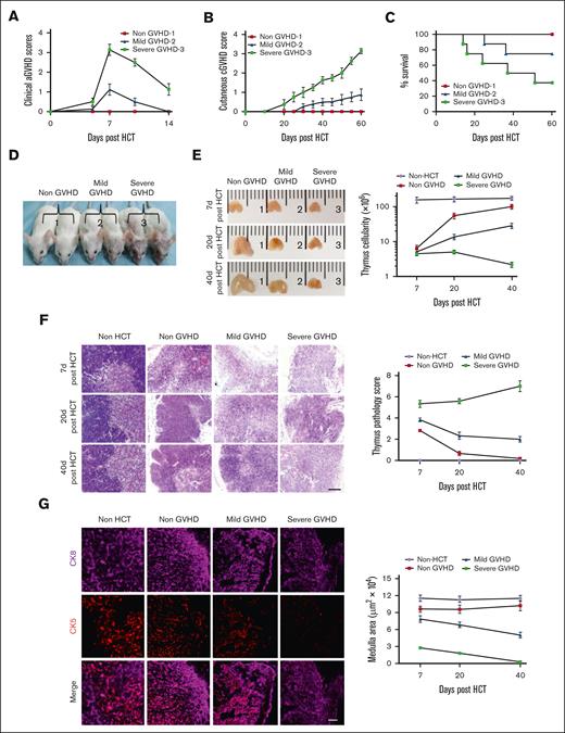 The degree of thymus damage was associated with severity of cGVHD. TCD-BM alone (∼2.5 × 106 cells, non-GVHD) or TCD-BM (2.5 × 106 cells) plus 1 × 106 cells splenocytes (severe-GVHD) or 0.25 × 106 splenocytes (mild-GVHD) from C57BL/6 mice were transplanted into BALB/c mice. Mice were monitored for aGVHD clinical symptoms, cutaneous cGVHD, and survival. Thymus structure were assessed 7, 20, and 40 days after HCT, with H&E staining. (A-C) aGVHD symptom scores, cutaneous cGVHD score, and percentage of survival. Each group contained between 12 and 16 recipients combined from 3 replicate experiments. (D) Picture taken on day 40 after HCT (1, non-GVHD; 2, Mild-GVHD; and 3, severe-GVHD). (E) The appearance of the thymus (n = 3) and thymus cellularity of each group results are shown as mean ± standard error (SE) (n = 6). (F) Representative photomicrographs of H&E-stained thymus tissue section and thymus pathology score, results are shown as mean ± SE (n = 6); scale bar, 50 μm. (G) Forty days after transplantation, thymuses were harvested and identified via immunofluorescent staining of CK8 (purple, highly expressed in cortex and lowly expressed in medulla) and CK5 (red, expressed in medulla), and medulla area was measured and shown as mean ± SE (n = 6); scale bar, 50 μm.