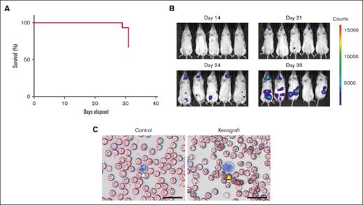 Characterization of the mouse xenograft model of APL. (A) The survival of mice (n = 15) was monitored between days 0 and 31. One mouse died on day 29, and 5 mice died on day 31. (B) Luciferase expression in NB4 cells in mice was measured on days 14, 21, 24, and 28. Five representative mice are shown. (C) Leukemic cells were identified in whole blood smears. A normal neutrophil is marked with a white arrowhead, and a leukemic cell is marked with a yellow arrowhead; scale bar, 50 μm.