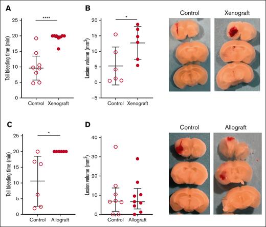 Tail and brain bleeding in the mouse xenograft and allograft models of APL. The mice that received (A) xenograft (n = 8 per group) and (B) allograft (n = 6 per group) and the respective controls were subjected to tail bleeding on days 28 and 24, respectively. The mice that received (C) xenograft (n = 6 per group) and (D) allograft (n = 8-9 per group) and their respective controls were subjected to intracranial bleeding on days 28 and 24, respectively. Representative images of brain slices are shown. Data are shown as median ± interquartile range (A,D) or mean ± SD (B,C), depending on normality. The Mann-Whitney U test (A,D), unpaired 2-tailed Student t test (B), and Welch t test (C) were used. ∗P < .05; ∗∗∗∗P < .0001.