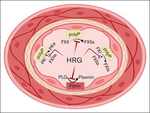HRG blocks FXII autoactivation to FXIIa, FXI activation to FXIa by FXIIa, and prekallikrein activation to plasma kallikrein by FXIIa on polyPs. All of these functions reduce thrombin formation. Alternatively, HRG, by binding to lysines on plasminogen, reduce plasmin formation such that if it were the only activity, it would contribute to thrombosis risk.
