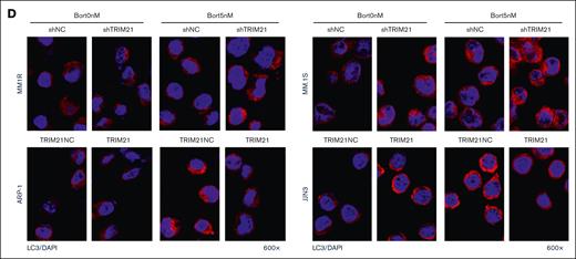 Bort activates prosurvival autophagy in TRIM21 KD MM cell lines. (A) Flow cytometry assay of total ROS expression of TRIM21 KD and TRIM21 OE MM1R, MM.1S, JJN3 and ARP-1 in the absence or presence of bort (5 nM; 24 hours). (B) Western blot analysis of IRE1α, PERK, Ero1-Lα, CHOP, and ATF6 proteins in TRIM21 KD, TRIM21 OE, and negative control MM cells, either untreated or treated with bort (5 nM, 24 hours). GAPDH was used as a loading control. (C) Western blot analysis of p62 and LC3 proteins (as autophagy markers), ATG5, ATG7, and ATG16L1 proteins (ATGs), and mTOR and p-mTOR in TRIM21 KD, TRIM21 OE, and negative control MM cells, either untreated or treated with bort (10 nM, 24 hours). GAPDH was used as a loading control. (D) Immunofluorescence assay of LC3 expression in TRIM21 KD, TRIM21 OE, and negative control MM cells in the absence or presence of bort. LC3-II expression is indicated by the strong red puncta. Original magnification: 600×, scale bar: 50 μm. The values are presented as the mean ± SD from 3 independent experiments. (∗P < .05; ∗∗P < .01; ∗∗∗P < .001).