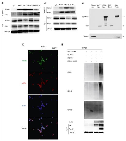 TRIM21 targets ATG5 directly and regulates ATG5 ubiquitination. (A) TRIM21 immunoprecipitated endogenous ATG5. ARP-1, MM.1S, MM1R, and RPMI8226 cell extracts were immunoprecipitated with an antibody against ATG5, along with the immunoglobulin G (IgG) control, followed by western blotting with an ATG5 antibody. (B) ATG5 immunoprecipitated endogenous TRIM21. ARP-1, MM.1S, and MM1R cells were lysed and immunoprecipitated with an ATG5 antibody, followed by incubation with TRIM21. (C) The GST-pull down test showed that ATG5 was directly bound to TRIM21. The GST-ATG5 fusion protein was ∼58 kDa in size. The HIS-TRIM21 protein was ∼52 kDa in size. We detected HIS-TRIM21 in the supernatant of bacterial lysates and in the supernatant of GST-ATG5 beads. GST alone was used as a negative control. GST-ATG5 and HIS-TRIM21 were purified from Escherichia coli. (D) Immunofluorescence staining assay showing TRIM21 and ATG5 subcellular colocalization in 293T cells. The nuclei were stained with 4′,6-diamidino-2-phenylindole (DAPI). Original magnification: 200×, scale bar: 100 μm. (E) TRIM21 OE 293T cells were treated with MG-132 (25 μm; 6 hours) and the whole-cell lysates (WCLs) were then collected for the detection of FLAG-TRIM21, HA-ATG5, and GAPDH protein levels by immunoblotting. The WCLs were subjected to IP using an anti-ATG5 antibody, and ubiquitinated ATG5 was evaluated with a related ubiquitin antibody.