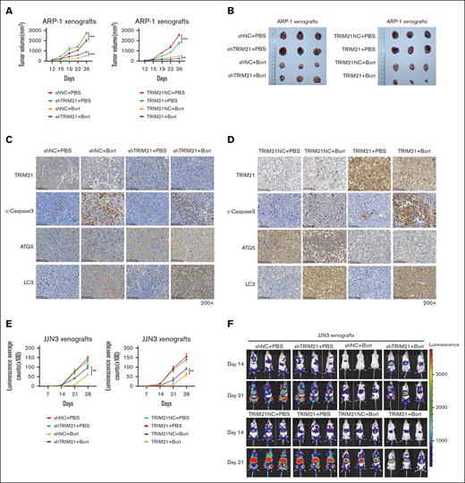In vivo evaluation of TRIM21 potentiates the antimyeloma effect of bort. A total of 5 × 106 TRIM21 KD or OE ARP-1 cells were subcutaneously injected into nonobese diabetic (NOD)-severe combined immunodeficiency (SCID) mice (n = 24). The tumor size was measured with a caliper, and PBS or bort (0.5 mg/kg) was injected every 3 to 4 days when the established tumors reached ∼100 to 130 mm3 on day 12. (A) Tumor volume of each group shown as mean ± SD. (B) Xenografts were excised and photographed on day 26. (C-D) Immunohistochemistry analysis of TRIM21, ATG-5, c-Caspase-3, and LC3 on tumor tissue sections from each group. Summary measurement of signals (E) and representative images of chemiluminescence (F) in the TRIM21 KD, TRIM21 OE and control group. Original magnification: 200×. Scale bars: 100 μm. (∗P < .05; ∗∗P < .01; ∗∗∗P < .001).