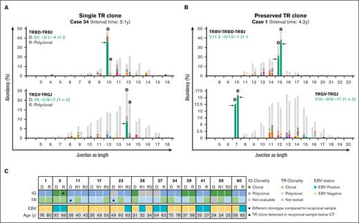 NGS-based T-cell clonality analysis identifies clonal TR gene rearrangements in cHL samples. (A) Representative data set indicating NGS-based detection of TR gene rearrangements in paired diagnosis (D) and recurrence (R) tissue samples of a case with a dominant T-cell clone in only the primary diagnosis but not recurrence (case 34). The results of 2 TCR targets (TRBV-TRBD-TRBJ and TRGV-TRGJ) are shown, and the specific clonotypes for the dominant TR gene rearrangements are indicated. On the x-axis, the junction aa length is shown, and the abundancy of clonotypes is shown in percentages on the y-axis. (B) Representative data set indicating NGS-based detection of TR gene rearrangements in paired samples with a preserved identical dominant T-cell clone (case 1). (C) Summary of IG- and TR-NGS clonality results of all patients with at least 1 sample with a dominant TCR clone. EBV status of all tumor samples and age of the patients are shown.