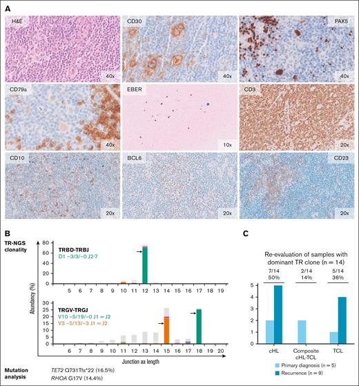 Molecular analysis and histomorphological reevaluation reveal AITL diagnosis in cHL recurrence. Histomorphology and molecular data of the recurrence sample of case 5. (A) The normal lymph node architecture has been replaced by a polymorphous infiltrate consisting of small- and medium-sized lymphocytes with scattered cells having large nuclei and prominent nucleoli, some of which are consistent with HRS-like cells. High-endothelial venules are prominent. The large cells show strong expressions of CD30 and PAX5 and a weak expression of CD79a. Epstein-Barr encoding region (EBER) in situ hybridization shows scattered positive cells of different size. Anti-CD3 staining reveals numerous small- to medium-sized T cells. Many of these cells are positive for programmed cell death protein 1 (PD1) (data not shown) and a small proportion shows expression of CD10 and BCL6. Anti-CD23 staining demonstrates slight expansion of irregular dendritic meshworks. The original magnification (×10, ×20 and ×40) is indicated. (B) TR-NGS clonality analysis shows the presence of clonal TRBD- TRBJ and TRGV- TRGJ rearrangements. Targeted mutation analysis reveals mutations in AITL-associated genes TET2 and RHOA; VAF is indicated. (C) Summary of morphological reevaluation of the samples with a dominant TCR clone with integration of molecular findings. In total, 7 samples of 5 patients were indicative for TCL.