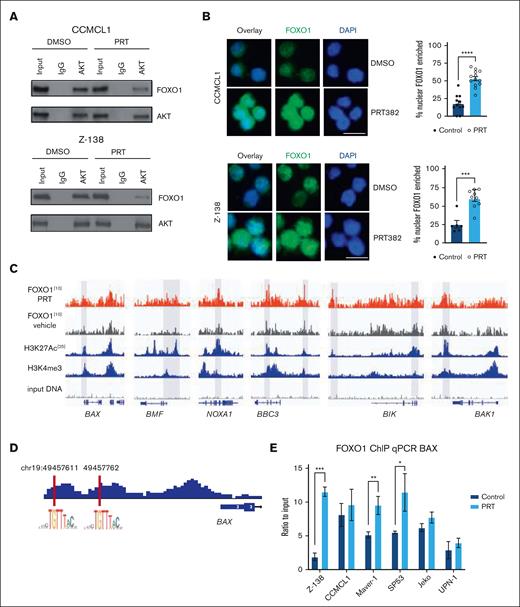 PRMT5 inhibition activates the FOXO1-dependent transcription program in MCL. (A) Immunoprecipitation of AKT in CCMCL1 and Z-138 cells shows the decrease in interaction between AKT and FOXO1 with treatment of 100 or 150 nM, respectively, of PRT382 for 6 days. (B) Immunofluorescence of CCMCL1 and Z-138 cell lines looking at the localization of FOXO1 after 72 hours of treatment with 100nM of PRT382 or dimethyl sulfoxide (DMSO). Cells are stained with FOXO1 primary antibody and alexafluor488-conjugated donkey anti-rabbit secondary. Cells were also stained with 4′,6-diamidino-2-phenylindole (DAPI). Images taken on an EVOS FL Cell Auto Imaging system at 40× original magnification. The number of cells with FOXO1 enriched in the nucleus was quantified and graphed. Scale bar, 10 μM. (C) Traces of ChIP sequencing performed on FOXO1 in CCMCL1 cells treated for 48 hours with 100 nM of PRT382 or DMSO as a control. Selected BCL-2 family proteins are shown here. (D) FOXO1 consensus sequence was confirmed in the promoter sequences of BAX upstream of the gene body. (E) FOXO1 ChIP qPCR of BAX showing significant enrichment in Z-138, Maver-1, and SP53 as well as a trend in CCMCL1, Jeko, and UPN-1 after 72 hours of PRT382 treatment. A student t test was performed to show significance for panels B,E. ∗P < .05; ∗∗P < .01; ∗∗∗P < .001; ∗∗∗∗P < .0001. Error bars show standard deviation of the data.