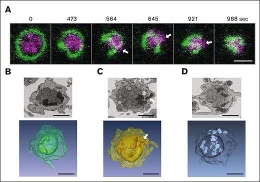 Compression and squeezing of mitochondria during platelet activation observed by live cell video microscopy and FIB-SEM images. (A) Live cell video microscopy of microtubule-tracker (green) and mitoTracker (magenta) stained human platelets during activation with thrombin (final concentration 0.034 U/mL). Still images of the supplemental Video 1 are shown at different time points as indicated. White arrows indicate mitochondria that get squeezed through the coiled marginal band; scale bar, 2 μm. (B-D) Single FIB-SEM image planes of platelets after activation with 1.25 μg/mL collagen (top) and below 3D reconstructions of FIB-SEM image stacks of platelets at activation states similar to those in the top panels. The white arrow indicates a mitochondrion that gets squeezed through the encircled center; scale bars, 1 μm.