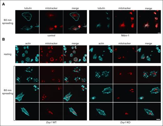 Drp1 is essential for mitochondrial organization in platelets. (A) Resting platelets were stained with mitoTracker (red) and then incubated for 30 minutes at RT with vehicle (control) or with the Drp1 inhibitor, Mdivi-1, at a final concentration of 50 μM. Platelets were then centrifuged onto the glass surface and placed into the incubator for 60 minutes at 37°C. Platelets were stained for tubulin (cyan) and shown are maximal projections of z-stacks. Scale bar, 2.5 μm (B) Resting and spread platelets of Drp1 WT and KO mice were incubated with the MitoView Fix 640, then either fixed immediately (resting) or centrifuged onto fibrinogen coated glass coverslips and incubated for 60 minutes at 37°C. Platelets were stained for actin (cyan) and shown are maximal projections of z-stacks. Scale bar, 2.5 μm
