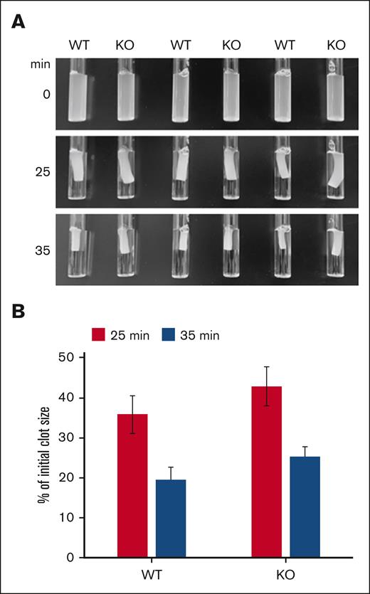 Drp1-deficient platelets show a delay in clot retraction. (A) Washed platelets from WT and Drp1-KO mice were resuspended in Tyrode buffer at 3×108/mL. Fibrinogen (800 μg/mL) and CaCl2 (12.5 mM) were added, and clot formation was initiated by adding thrombin (1.7 U/mL). The clots were allowed to retract, and images were taken at indicated time points. (B) The extent of clot retraction was quantified as percent of the initial clot volume using the images shown in panel B. Results are expressed as means ± standard deviations (P = .03078 at 35 minutes). Shown is a representative experiment repeated 3 times.