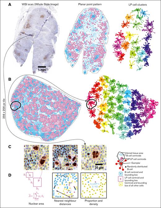 Spatial variable extraction from digital slides using deep-learning, affinity-propagation clustering, and spatial statistics. (A) Left to right: Whole-slide image scan of an OCT2-stained tissue section of NLPHL with Fan pattern “C.” A highlighted 256 × 256-pixel tile is magnified in panel C. The planar point pattern after cell detection, showing LP cell and B-cell centroids. LP cell clusters are identified using affinity-propagation clustering. (B) Planar point pattern and result of affinity-propagation clustering of LP cell centroids in an NLPHL case with Fan pattern “A.” A specific cluster is highlighted in both the point pattern and cluster plot. (C) Individual tiles with detected cells enclosed within bounding boxes. The deep-learning detection precision was 95.43%. (D) Point patterns of the tiles with symbols indicating different cell types and spatial variables, including the area of bounding boxes as an approximation of the nuclear area, nearest neighbor distances between cell centroids, and point counts for cell density calculation.