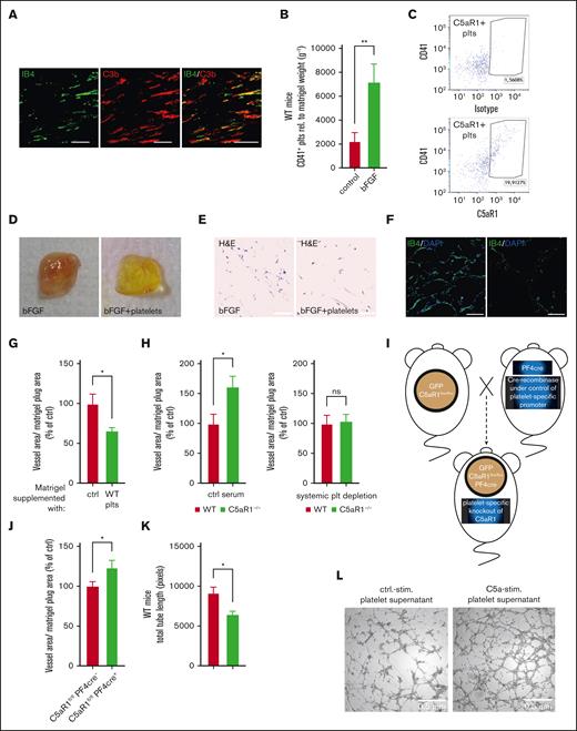 The platelet C5aR1 contributes to growth factor-mediated angiogenesis. In vivo Matrigel plug assay experiments were carried out as described in the “Materials and methods.” (A) We detected increased complement activation (C3b, red) in the angiogenic tissue, which colocalizes with vascular structures (IB4, green). (B-C) After 7 days, matrigels were explanted, and a single-cell suspension generated from the plugs was analyzed by flow cytometry. We observed increased presence of platelets (CD41+; B) and the presence of C5aR1 on platelets (CD41+CD45−C5aR1+; C). n = 7 to 8 ∗P < .05, ∗∗P < .01. (D-G) Isolated platelets were coinjected with bFGF into the Matrigel solution before implantation into mice. We observed an inhibition of neovascularization by platelet addition. (D) Panel D shows reduced macroscopic vascularization in explanted plugs, which was associated with reduced cellularity (E) (H and E staining) and reduced green signal (F) (IB4 staining for vessels). (G) n = 7 to 8 plugs were analyzed. Matrigels injected with vehicle control represent 100%. ∗P < .05 in comparison to control. (H) WT or C5aR1−/− mice were applied in the Matrigel plug in vivo assay. We observed increased angiogenesis in the absence of C5aR1. n = 8 to 11 plugs were analyzed. The group with WT mice represents 100%. ∗P < .05. When platelets were depleted systemically by injection of platelet-depleting serum, we could not detect significant differences in angiogenesis. Data are shown as the mean ± SEM (n = 7 animals per group) and are displayed as % of WT mice. ns = no statistically significant difference could be observed. (I) PF4-cre+C5aR1fl/fl mice were generated as described in “Methods.” (J) Platelet-specific C5a receptor 1 knockout mice showed increased revascularization. Data are presented as the mean ± SEM (n = 9) and are displayed as % of the perfusion in the contralateral control limb. ∗P < .05 in comparison to cre-negative WT mice. (K-L) MHEC-5T were coincubated with platelet releasate after C5a stimulation. C5a-stimulated WT platelet supernatant inhibited endothelial tube formation. Data are displayed as the mean ± SEM (n = 5). ∗P < .05. (L) Panel L shows representative images of these in vitro experiments.