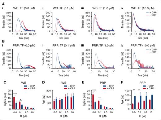 TF concentration dependent effect of GPVI-induced platelet activation in TG. Parallel samples of WB (A) and PRP (B) were triggered in the absence of TF (i), or with 0.1 pM TF (ii), 1 pM TF (iii), or 10 pM TF (iv). Preincubation was with 25 μg/mL CRP-XL, where indicated (+CRP). Traces are representative of 3 independent experiments (A and B). Plots of TG lagtime and thrombin peak levels in the whole blood (C-D) or PRP (E-F). Means ± SD (n = 3); 2-way ANOVA, ∗P < .05; ∗∗P < .01; ∗∗∗P < .001; ∗∗∗∗P < .0001. See further details in Datafile 1.