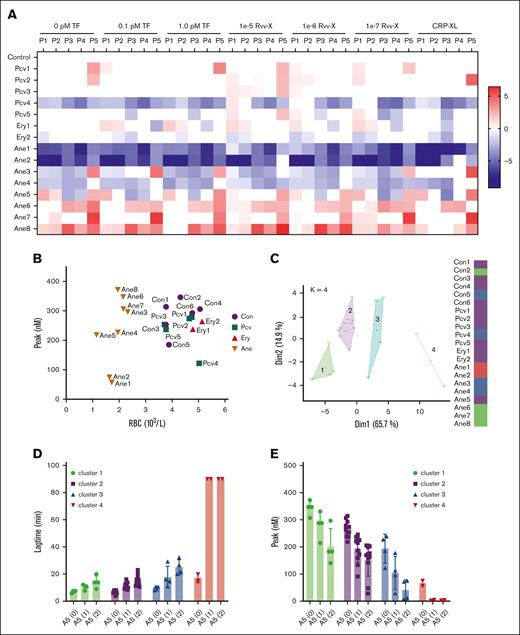Changes in TG in blood from patients with altered RBC traits. Blood was investigated from day-control subjects (Con), or from patients with polycythemia vera, erythrocytosis, or anemia of various causes (Table 1). WB TG was measured in response to vehicle, TF (0.1, 1.0 pM), or Rvv-X (dilutions 1e-5, 1e-6, 1e-7). Where indicated, platelets in blood were stimulated with CRP-XL (25 μg/mL, 0.1 pM TF). Parameters of TG curves were univariate scaled from 0 to 10 across all conditions, and differences per patient vs means of control participants were obtained. (A) Subtraction heat map of TG parameters (scaled 0-10) from 15 patient samples per indicated trigger. Note reversed scaling for lagtime and time-to-peak (TTP). Differences were filtered for changes outside of means ± SD. Color codes: blue, decrease; red, increase. (B) Plot of RBC count and thrombin peak level (0.1 pM TF) per subject. (C) Results of principal component analysis of combined TG and hematologic parameters (supplemental Figures 7 and 8). Colors indicate 4 clusters, with each dot representing 1 subject. (D-E) Effect of annexin A5 addition (vehicle, 1 or 2 μg/mL) on lagtime (D) and peak level (E) at 0.1 pM TF per cluster of subjects (clustered according to panel C). For full data, see Datafile 1. Ane, anemia; Ery, erythrocytosis; Pcv, polycythemia vera.