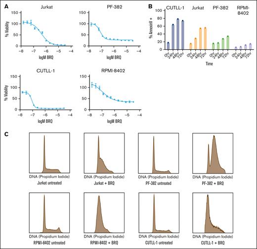 Inhibition of DHODH leads to cell cycle arrest and apoptosis in T lymphoblasts. (A) Treatment of T-ALL cell lines with BRQ, showing dose-dependent decreases in cell viability, as measured by CellTiter-Glo. Shown are the mean ± standard deviation of 3 replicates. (B) T-ALL cell lines were treated with 1 μM BRQ. Graph showing a time-dependent increase in annexin V staining measured by flow cytometry. Shown are data from a representative experiment, which was repeated 3 times. (C) Treatment of T-ALL cell lines in vitro with 1 μM BRQ for 72 hours resulted in an S-phase arrest. Shown are data from a representative experiment, which was repeated 3 times.