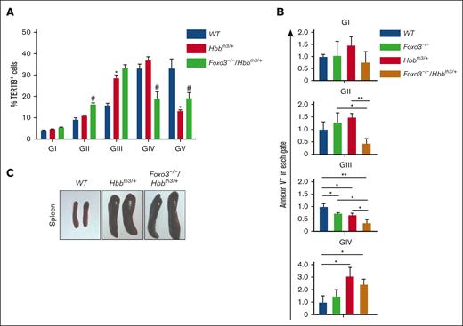 Loss of FOXO3 improves RBC production in β-thalassemia. (A) FOXO3 ablation alters BM erythroblast frequencies. ∗P < .05 between WT and Hbbth3/+ groups and #P < .05 between Hbbth3/+ and Foxo3−/−/Hbbth3/+ groups (n ≥ 3). (B) Fold change of annexin V+ cells in live Foxo3−/−, Hbbth3/+, and Foxo3−/−/Hbbth3/+ relative to WT BM TER119+ cells in each gate. ∗P < .05, ∗∗P < .01. (C) Macroscopic examination of the spleen from WT, Hbbth3/+, and Foxo3−/−/Hbbth3/+. Results are shown as mean ± SD.